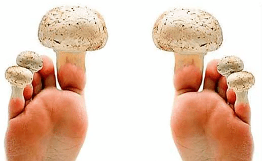 Champignon sur les ongles