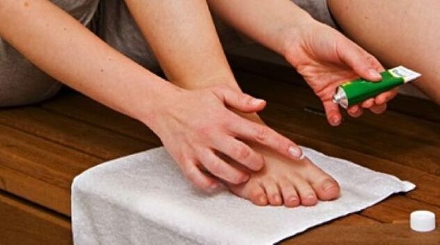 Traitement des champignons des ongles avec pommade