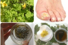 remèdes populaires contre la mycose des ongles des pieds